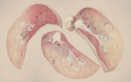 a drawing of a diagram of the lungs